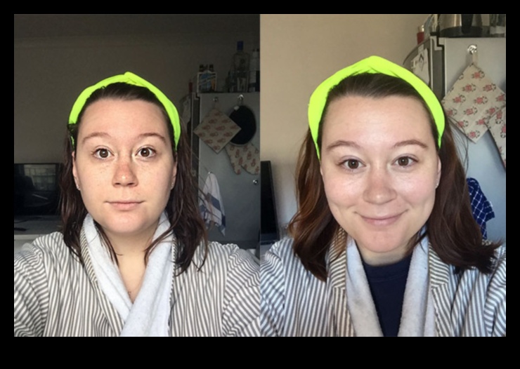 نظام كيتو الغذائي هل يحسن صحة الجلد 3 تأثير النظام الغذائي الكيتوني على صحة الجلد